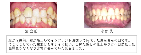 症例