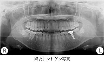 症例