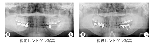 症例
