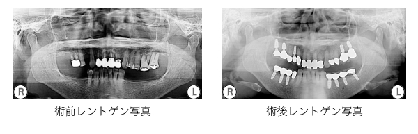 症例