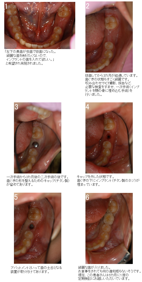 症例
