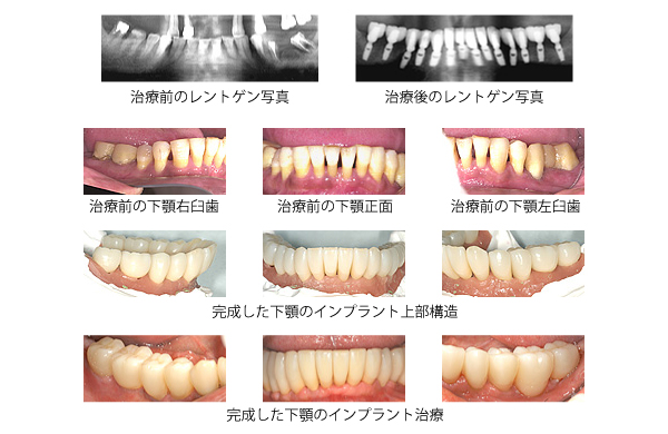 症例
