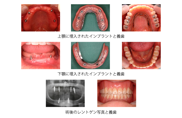 症例