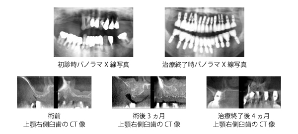 症例